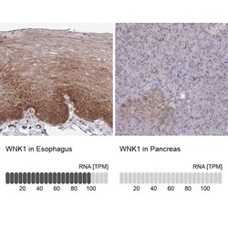 WNK1 Antibody, Novus Biologicals:Antibodies:Primary Antibodies